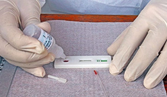 Preços de exames da Covid têm variação de 253,54% em MS