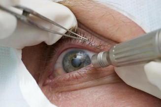Pandemia faz cair detecção precoce de glaucoma