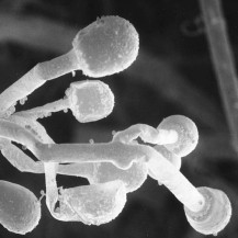 MS investiga segundo caso suspeito de mucormicose em paciente com covid-19