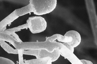 MS investiga segundo caso suspeito de mucormicose em paciente com covid-19