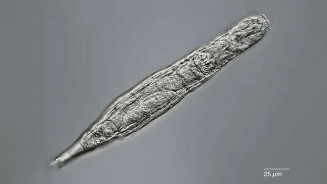 Os rotíferos bdelóides podem entrar na criptobiose para sobreviver a condições extremas, como temperaturas congelantes e secas. REPRODUÇÃO /MICHAEL PLEWKA