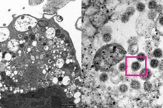 Congresso discute efeitos da covid-19 na função erétil e urinária