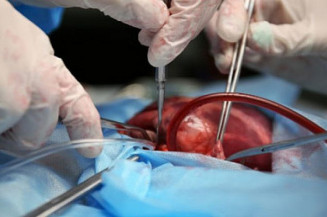 Setembro Verde: Cem sul-mato-grossenses renasceram com transplante de órgãos em 2020