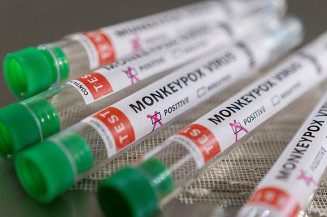 Sobe para 37 número de casos de varíola dos macacos no Brasil