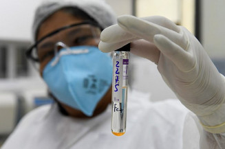 Laboratório passará a fazer sequenciamento genômico da turberculose em MS