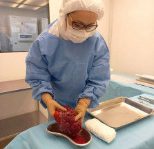 Pesquisa desenvolve curativos biológicos à base de placenta