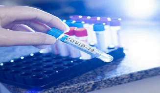 Número de casos Covid – 19 continua alto e médias são preocupantes, alerta Governo