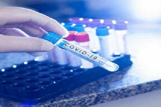 Número de casos Covid – 19 continua alto e médias são preocupantes, alerta Governo