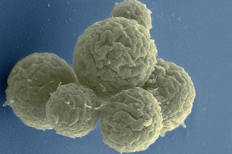Cientistas avançam na pesquisa com genoma sintético
